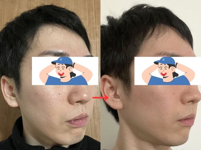 ビフォーアフター