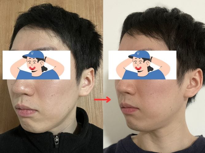 ビフォーアフター